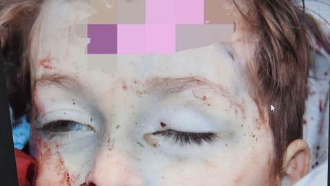 Thumbnail for slaughtered child